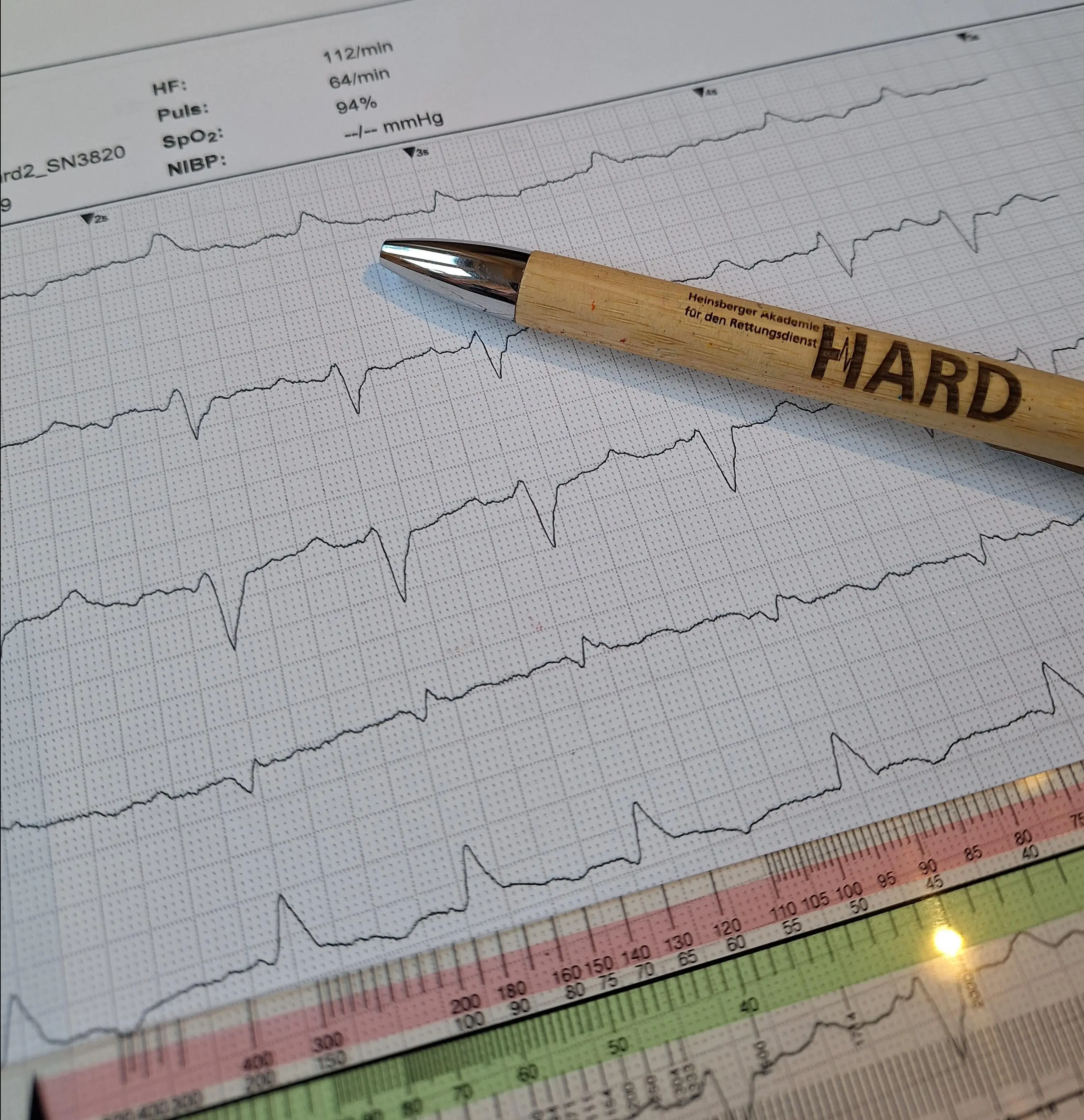 Update EKG - über den Kreis zur Zacke